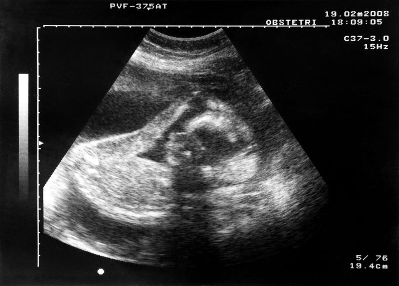 الجنين في الأسبوع الثاني والثلاثون من الحمل