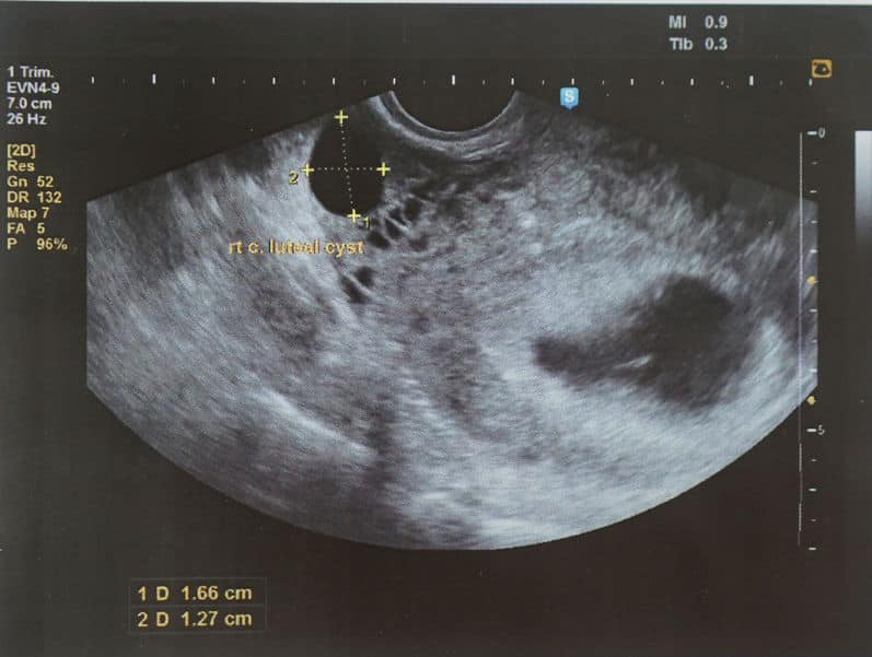 الجنين في الأسبوع الحادي والعشرون من الحمل