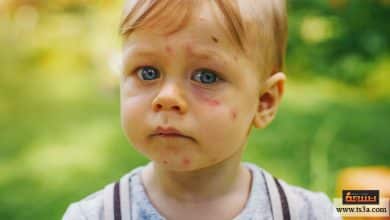 Photo of كيف تتعاملي مع مشكلة جفاف جلد الرضيع وما الذي يسبب ذلك العرض ؟