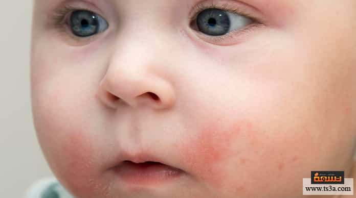 Photo of ماذا تعني تغيرات لون بشرة الرضيع وكيف يمكنك فهمها ؟ وأهم أسباب حدوثها