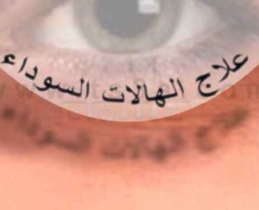 الهالات السوداء علاج الهالات السوداء