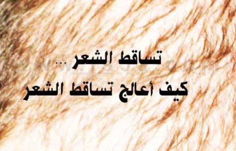 كيف أعالج تساقط الشعر ؟