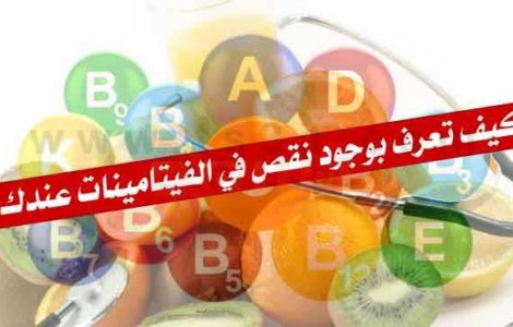 كيف تعرف بوجود نقص في الفيتامينات عندك