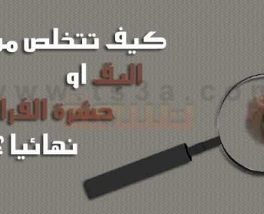 كيف تتخلص من البق او حشرة الفراش
