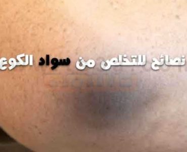 كيف تتخلص من سواد الكوع ومن الجلد الميت
