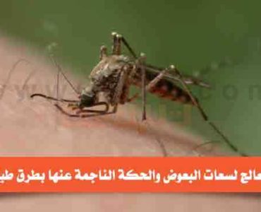 كيف تعالج لسعات البعوض والحكة طبيعيا