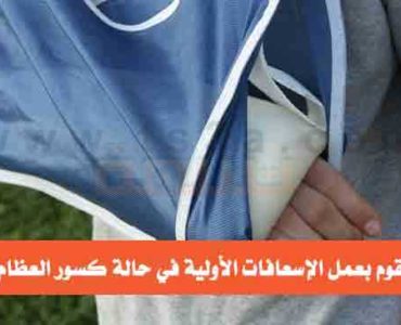 الإسعافات الأولية في حالة كسور العظام