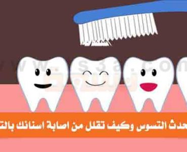 كيف يحدث التسوس وكيف تقلل من اصابة اسنانك بالتسوس