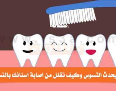 كيف يحدث التسوس وكيف تقلل من اصابة اسنانك بالتسوس