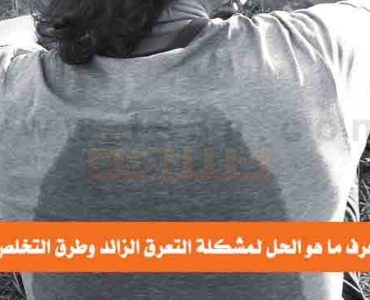 حل مشكلة التعرق الزائد