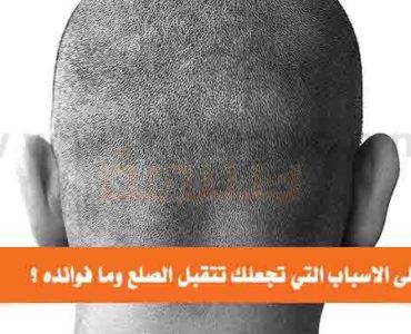 فوائد الصلع اسباب تقبل الصلع