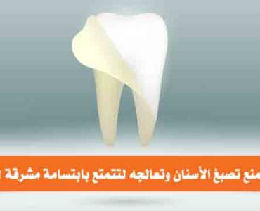 كيف تمنع تصبغ الأسنان
