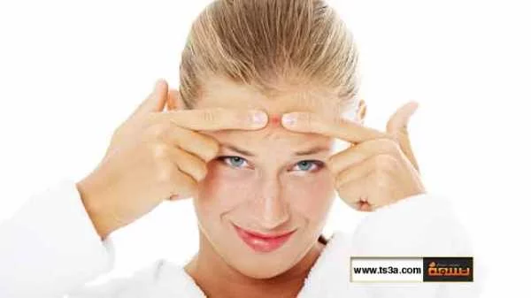 كيف يمكن علاج حب الشباب