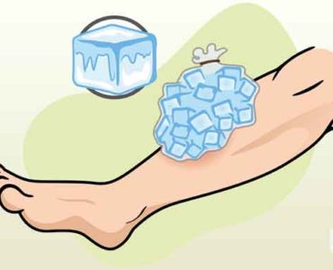 الثلج في علاج الإصابات الكدمات
