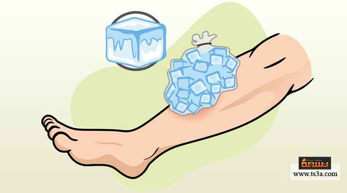 الثلج في علاج الإصابات الكدمات
