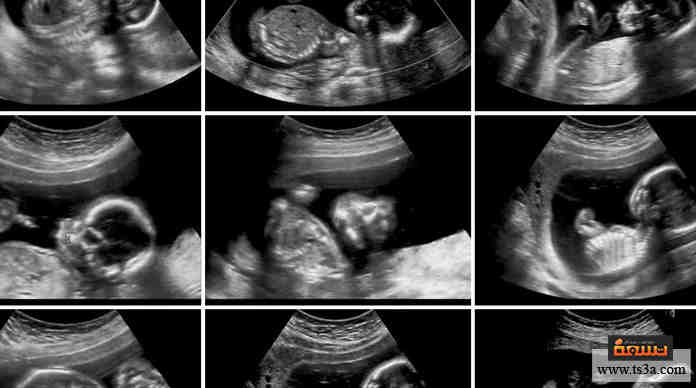 جنس المولود كيف يمكن التمييز بين حمل البنت وحمل الولد تسعة