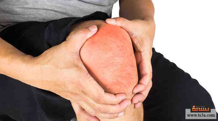 علاج النقرس بالأعشاب علاج النقرس بالأعشاب