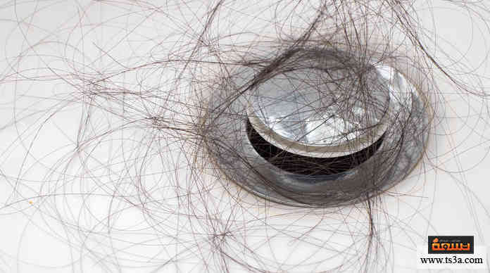 تساقط الشعر بعد الولادة