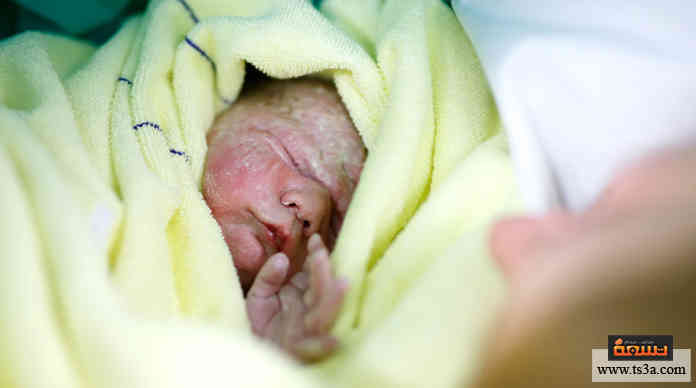 أول ولادة قيصرية وأصل التسمية