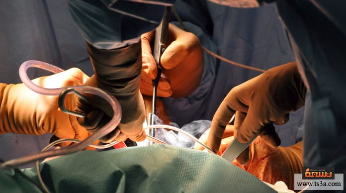 جراحة الأجنة أنواع عمليات جراحة الأجنة