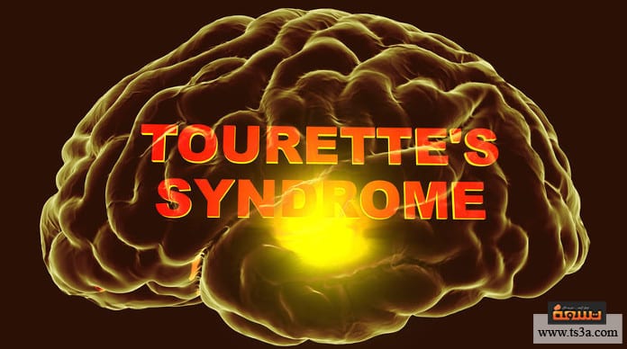 متلازمة توريت ما أهم أعراض متلازمة توريت؟
