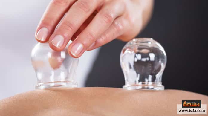 كيف يمكن علاج عرق النسا بالحجامة دون مخاطر طبية؟